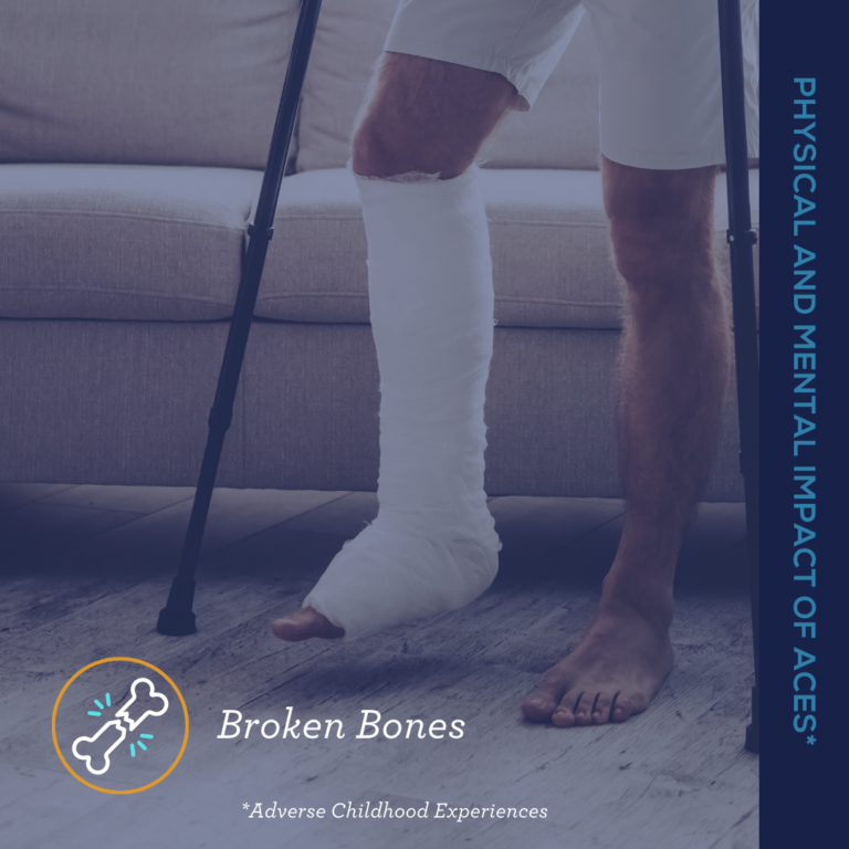 Broken Bones Social Graphic